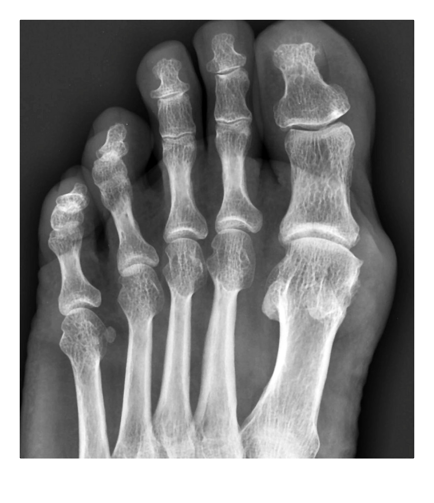 dna_moczanowa-001-2014-11-26 _ 09_32_48-80