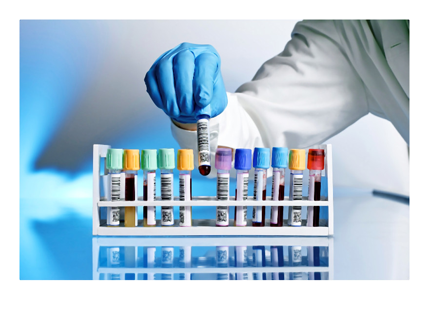 probowki_z_krwia-003-2014-11-26 _ 09_32_48-80